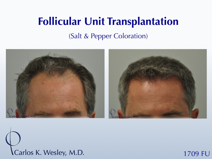 Slide1.jpg